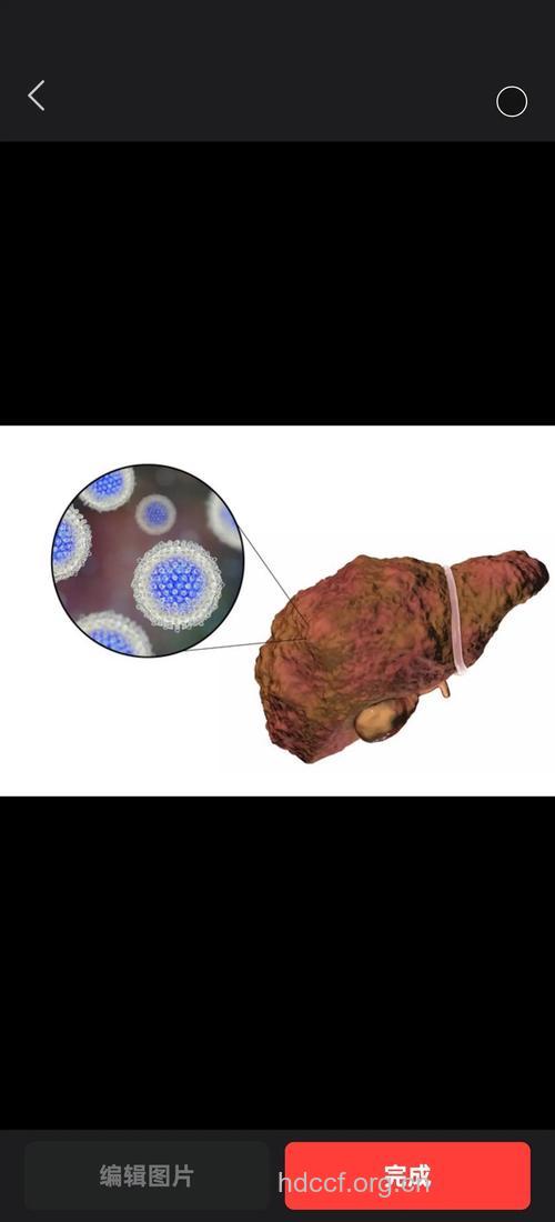 乙肝病毒真面目