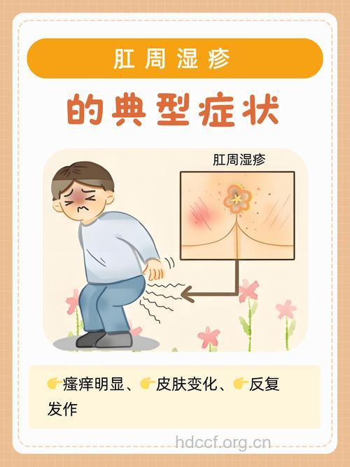 对于肛门湿疹有哪些类型