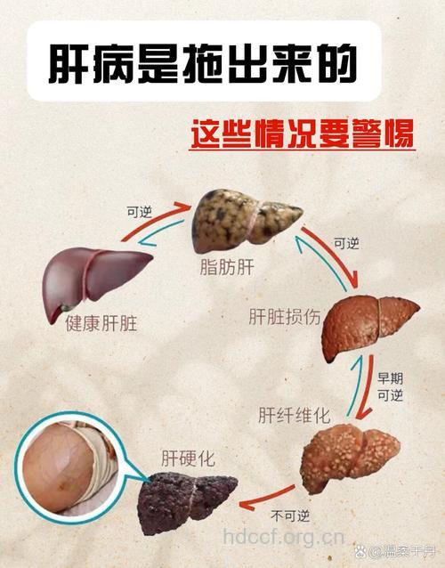 看！肝炎这样恶化为肝癌