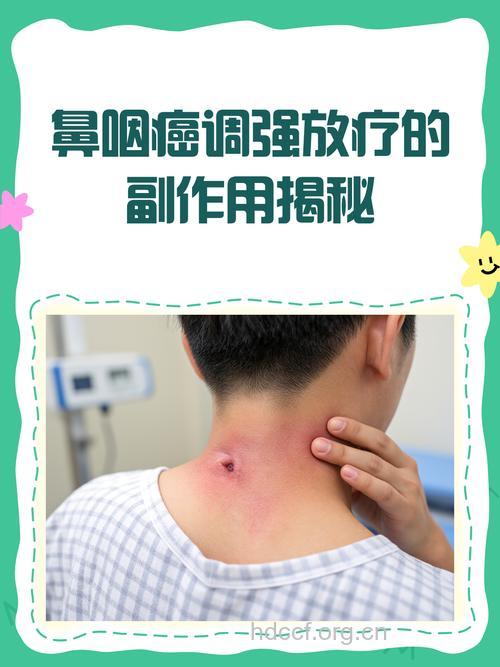 鼻咽癌化疗有副作用吗