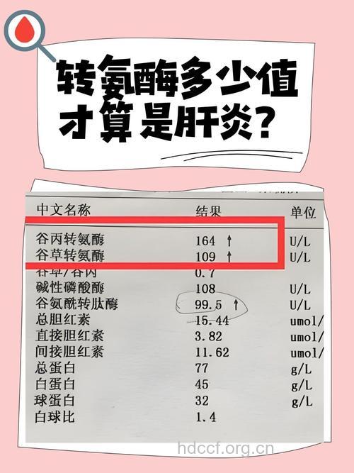 转氨酶高意味病毒性肝炎吗