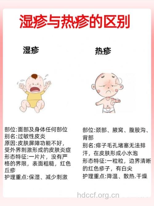 婴儿湿疹也是过敏性疾病