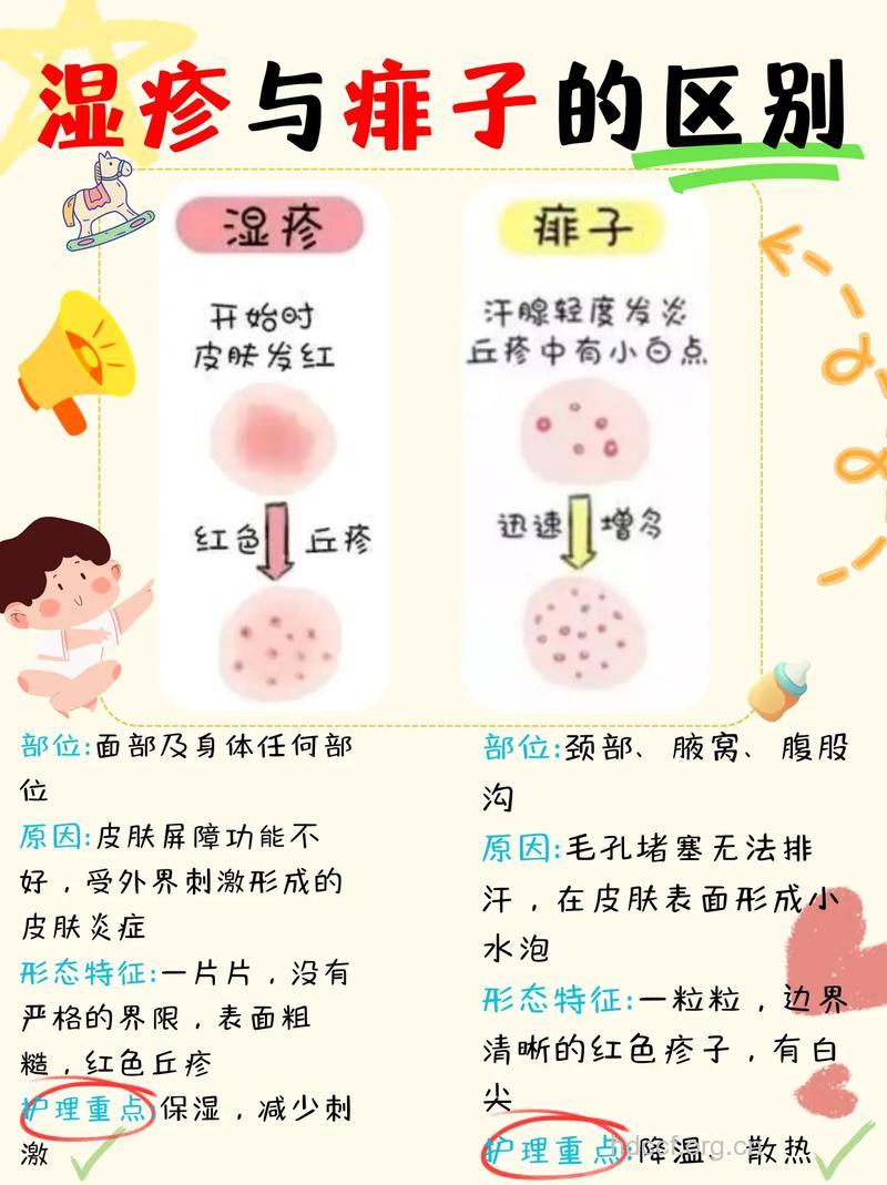 婴儿湿疹病发常见五大原因