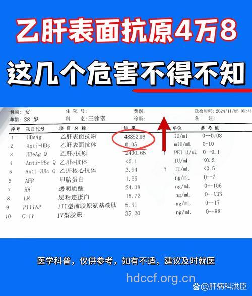乙肝传染性高的6情况