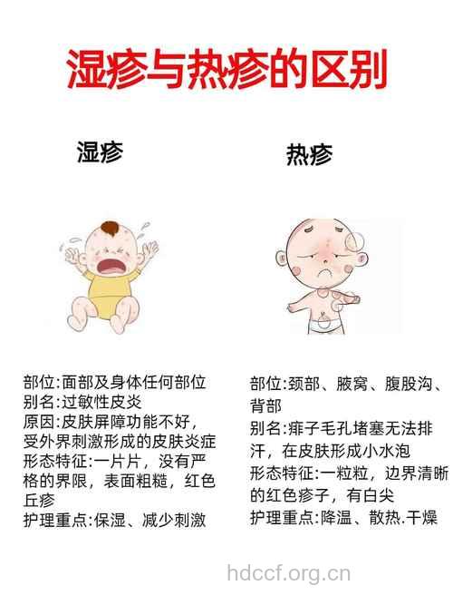 baby得了湿疹 父母该怎么做?