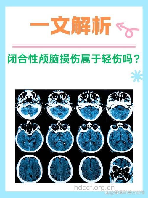 闭合性脑外伤有那些症状