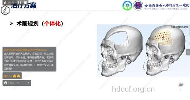 颅骨缺损的手术和预防