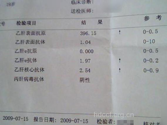 怎样看乙肝五项检查单？