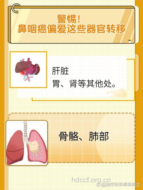 鼻咽癌有那些转移途径?