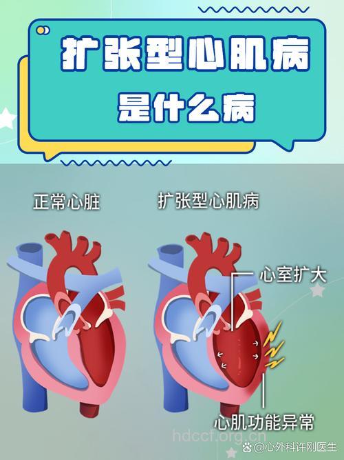 什么因素导致扩张性心肌炎