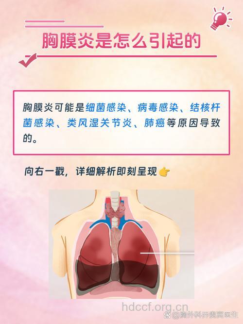 患上胸膜炎的原因有哪些