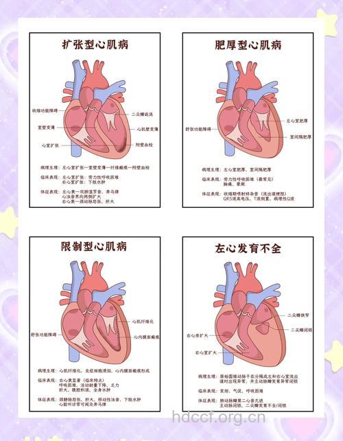 如何诊断限制型心肌