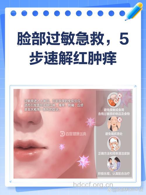 脸上皮肤过敏怎么解决呢