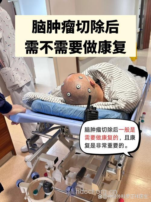 晚期脑肿瘤有哪些治疗方法