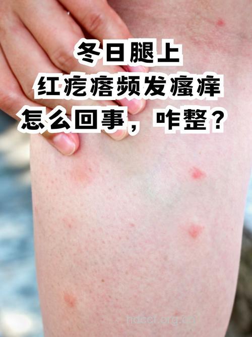 冬季的皮肤过敏有什么症状