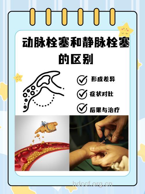 关于动脉栓塞有什么类型