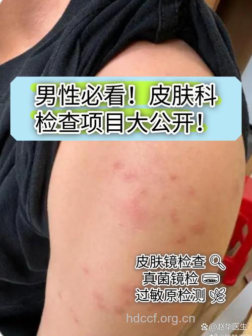 皮肤瘙痒该做哪些检查?