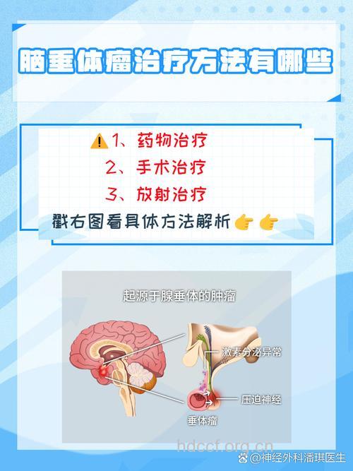 放疗治疗脑垂体瘤有哪些注意事项