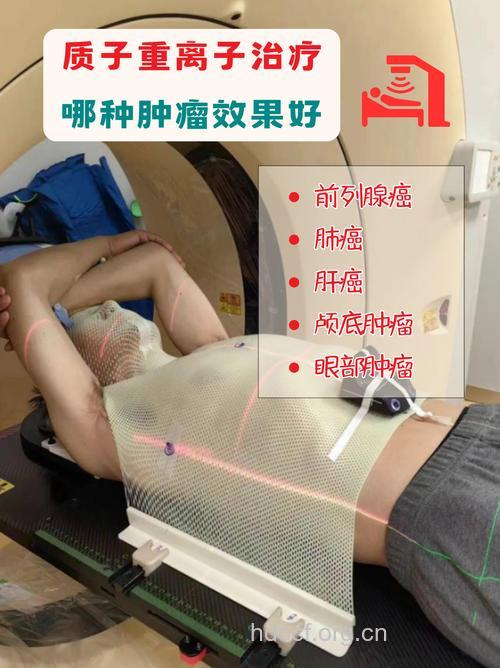 哪些肿瘤疾病放疗治疗效果好