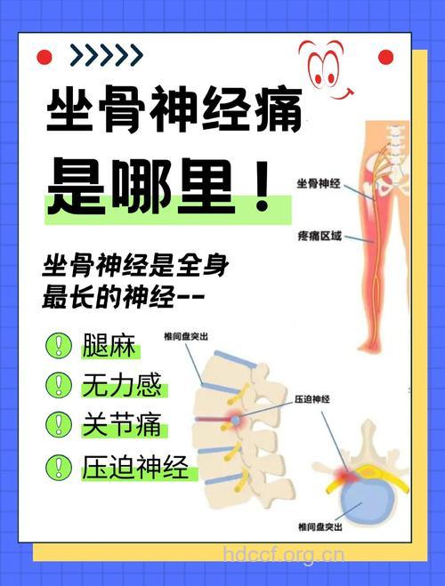 坐骨神经痛有哪些症状 6大方法能预防