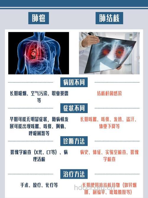 肺癌和肺结核怎么区别诊断
