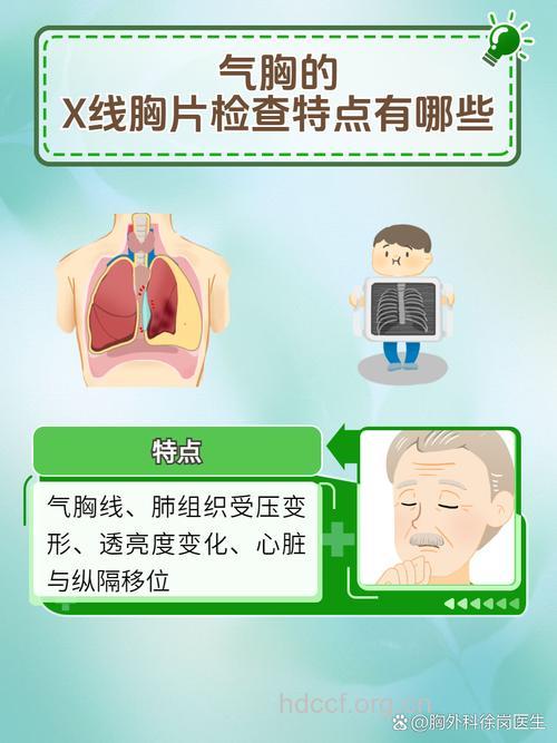 气胸应该怎么做检查