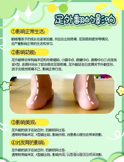 扁平足的矫正方法及原则