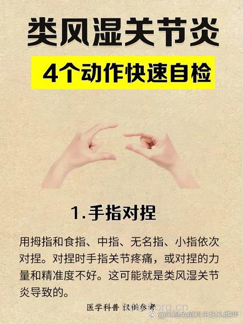 风湿性关节炎的检查事项