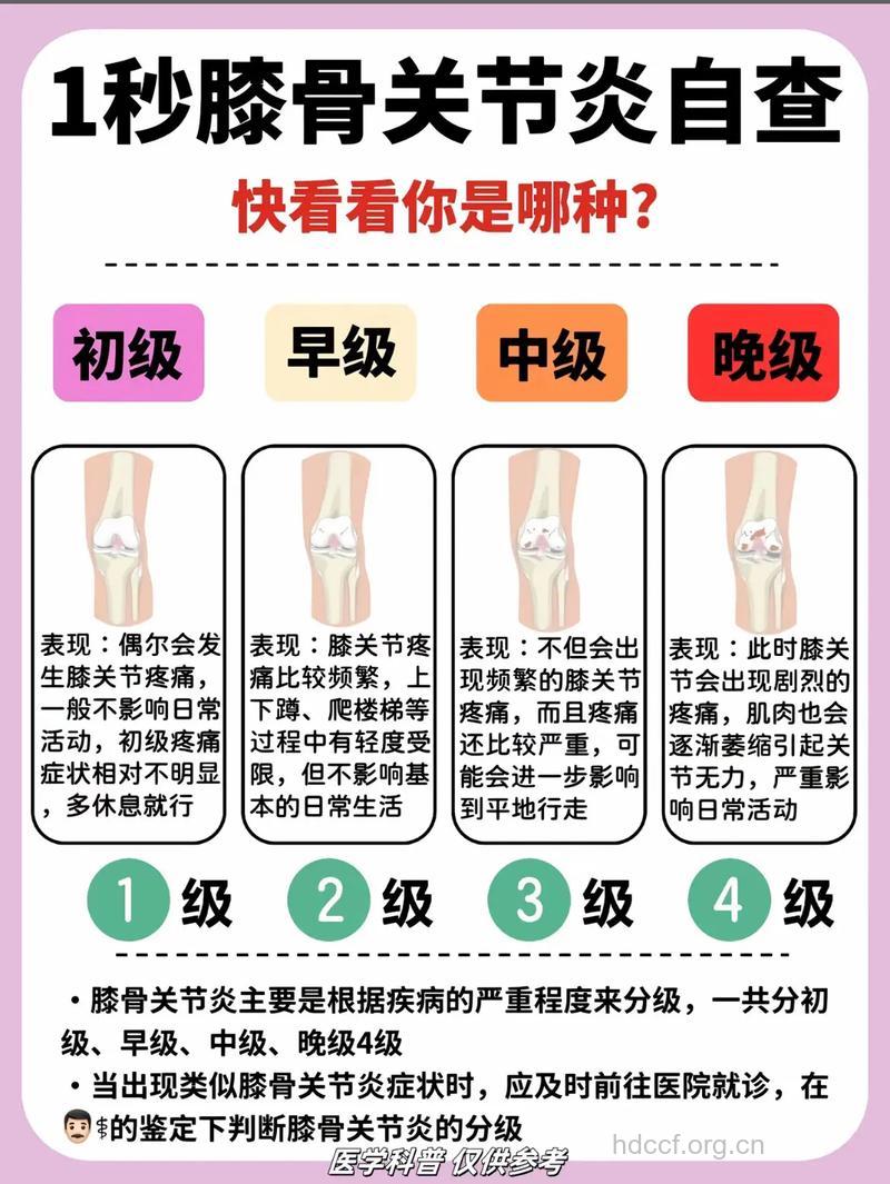 如何判断自己是否有膝关节炎