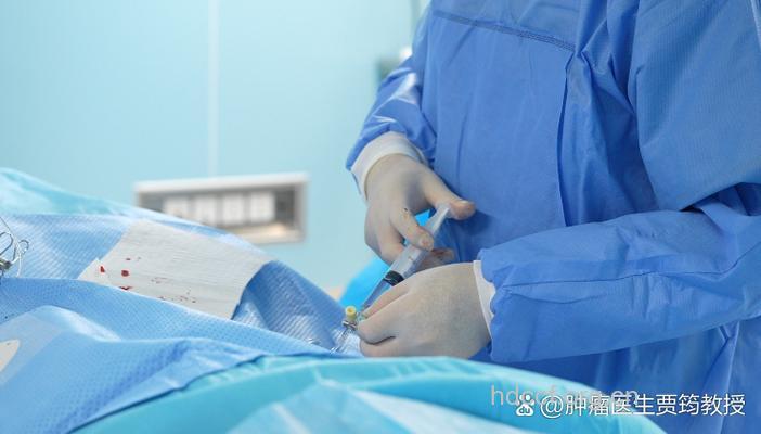 介入栓塞治疗肾癌效果好吗