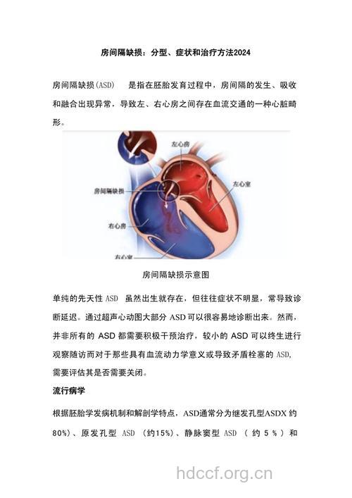 房间隔缺损有哪些治疗方法