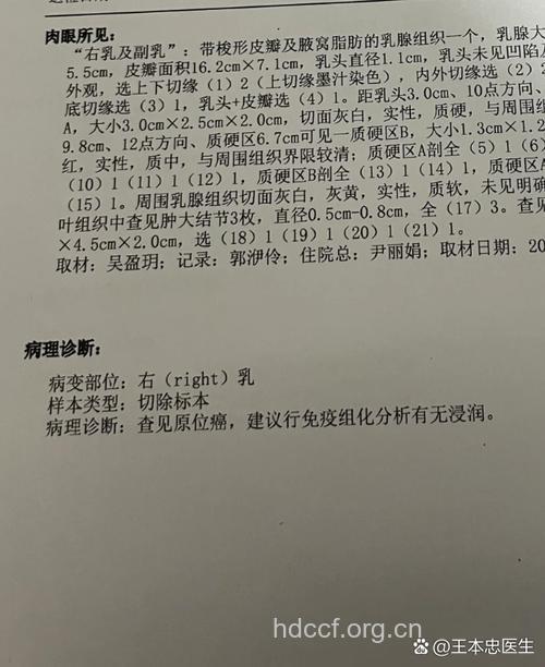 肿瘤切除后还需要做病理诊断吗