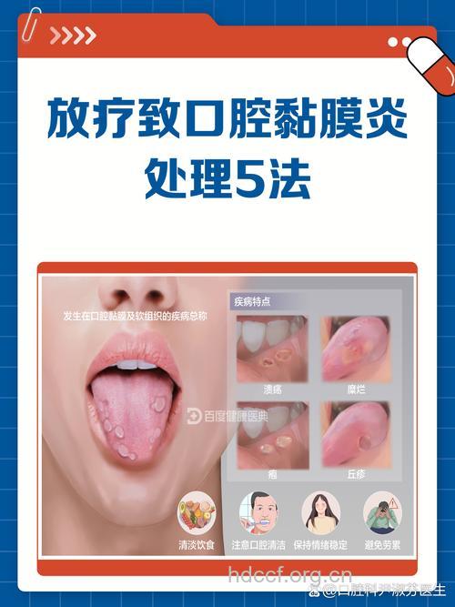 化疗后口腔溃疡预防及处理