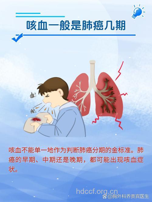 咳嗽警惕:已到肺癌中晚期