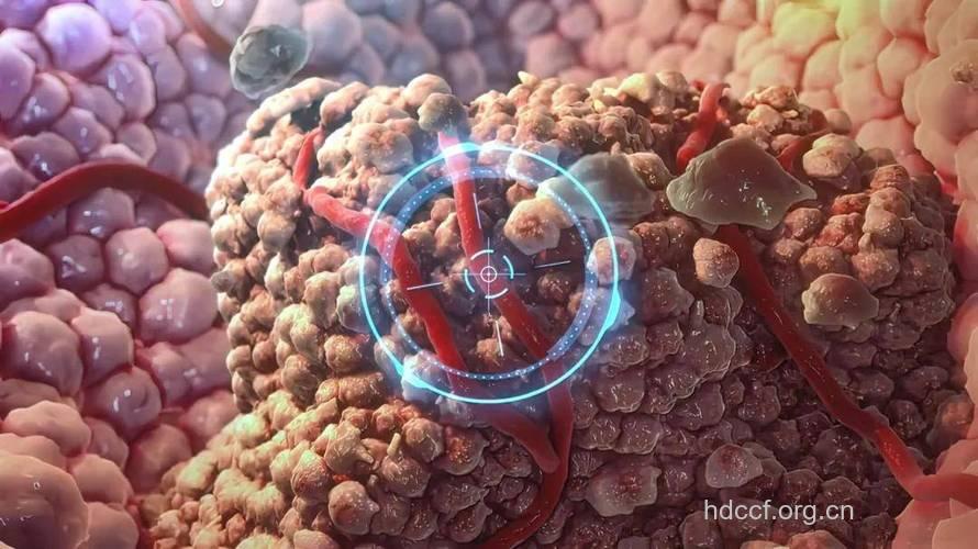 消灭癌细胞——“生物导弹”