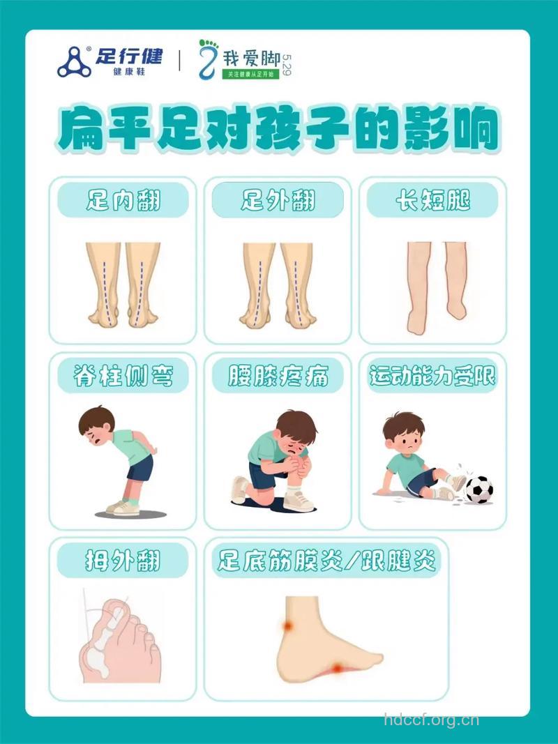 预防小儿扁平足要注意什么