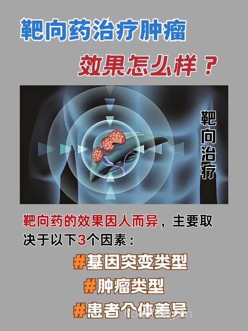 解读：胃肠道间质瘤的靶向治疗