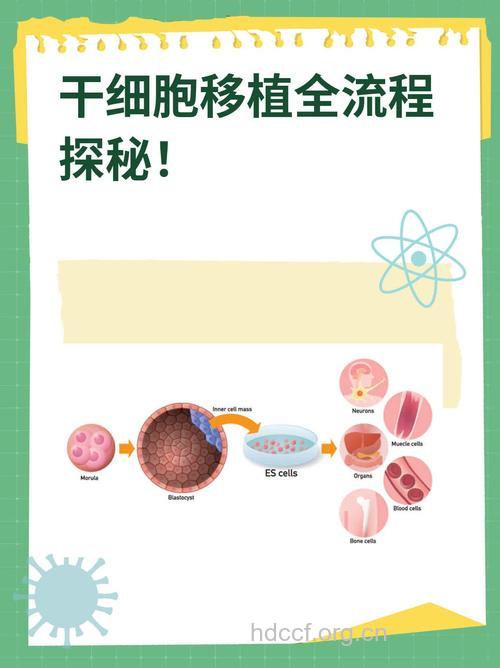 如何选择淋巴瘤干细胞移植