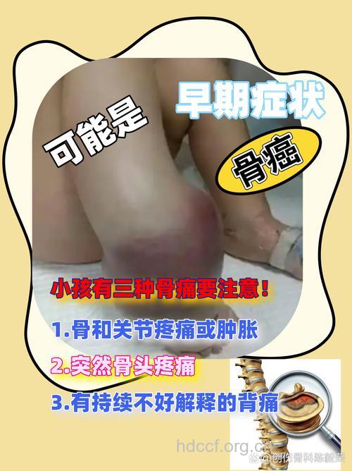 儿童不明原因的疼痛小心是骨癌