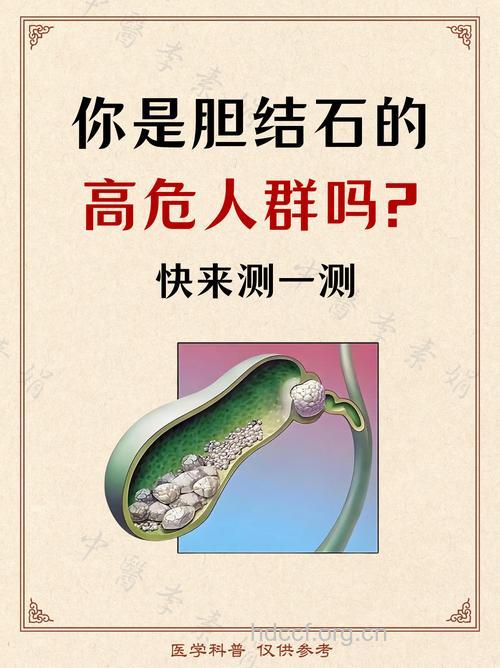 胆结石更偏爱4类人群