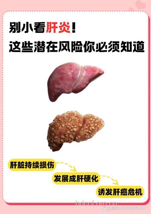 盘点5种肝炎的危害 哪种肝炎的危害最大？