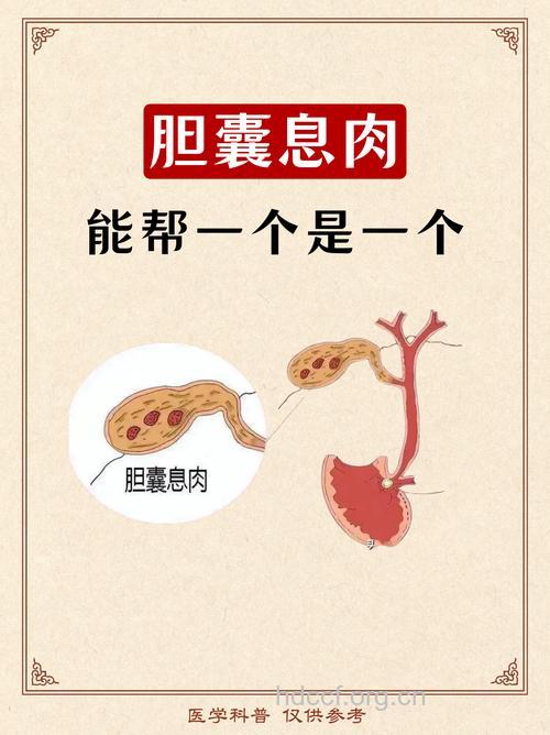 胆囊息肉的症状与治疗