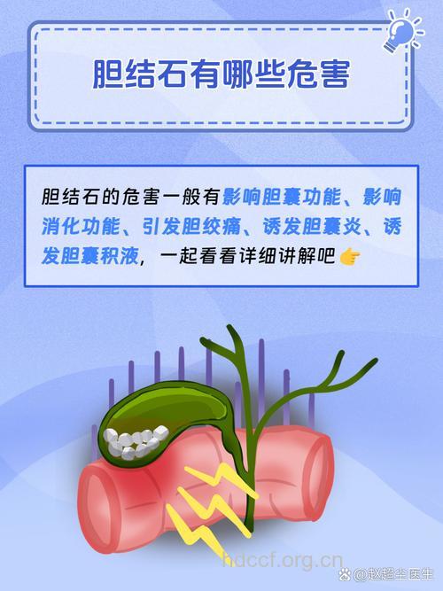 胆结石不治疗会有什么后果