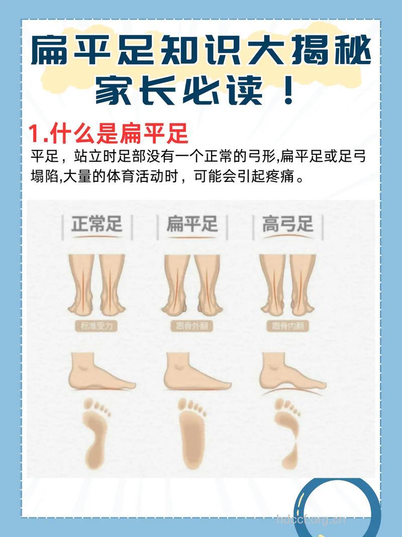 专家解释你应知的痉挛性扁平足