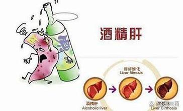 护理酒精肝患者的方法
