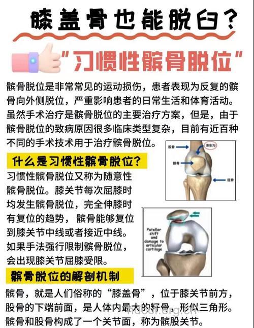 常见关节脱位释义及恢复建议