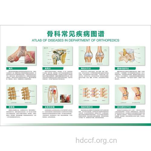 常见骨科病及具体信息