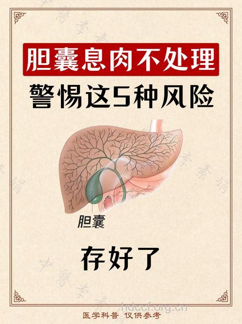 胆囊息肉常见的三个发病因素