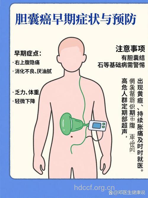胆囊癌患者有什么早期症状