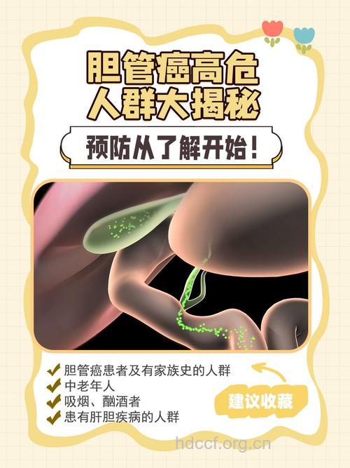 哪些人群容易导致胆囊癌